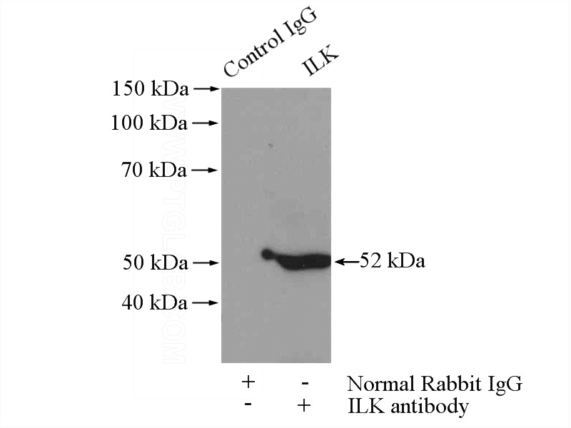IP Result of anti-ILK (IP:Catalog No:111752, 4ug; Detection:Catalog No:111752 1:800) with mouse kidney tissue lysate 4000ug.