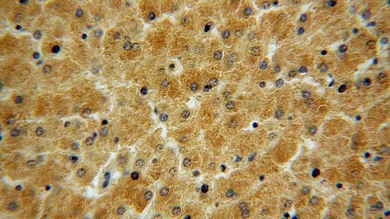 Immunohistochemical of paraffin-embedded human liver using Catalog No:107791(ADHFE1 antibody) at dilution of 1:50 (under 40x lens)