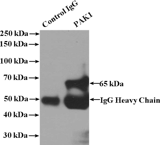 IP Result of anti-PAK1 (IP:Catalog No:113496, 4ug; Detection:Catalog No:113496 1:1000) with K-562 cells lysate 3200ug.