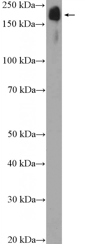 mouse heart tissue were subjected to SDS PAGE followed by western blot with Catalog No:116159(TNS1 Antibody) at dilution of 1:300