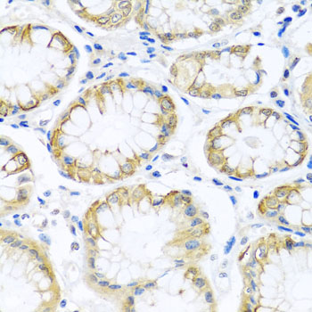 Immunohistochemistry - PCDHA12 Polyclonal Antibody 