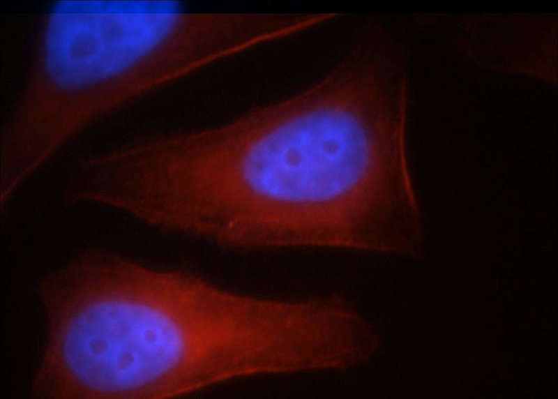 Immunofluorescent analysis of HepG2 cells, using MYH10 antibody Catalog No:112929 at 1:25 dilution and Rhodamine-labeled goat anti-rabbit IgG (red). Blue pseudocolor = DAPI (fluorescent DNA dye).