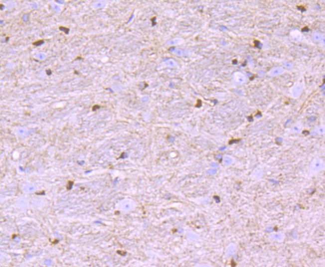Fig9:; Immunohistochemical analysis of paraffin-embedded mouse brain tissue using anti-Nogo antibody. The section was pre-treated using heat mediated antigen retrieval with Tris-EDTA buffer (pH 9.0) for 20 minutes.The tissues were blocked in 1% BSA for 30 minutes at room temperature, washed with ddH; 2; O and PBS, and then probed with the primary antibody ( 1/50) for 30 minutes at room temperature. The detection was performed using an HRP conjugated compact polymer system. DAB was used as the chromogen. Tissues were counterstained with hematoxylin and mounted with DPX.