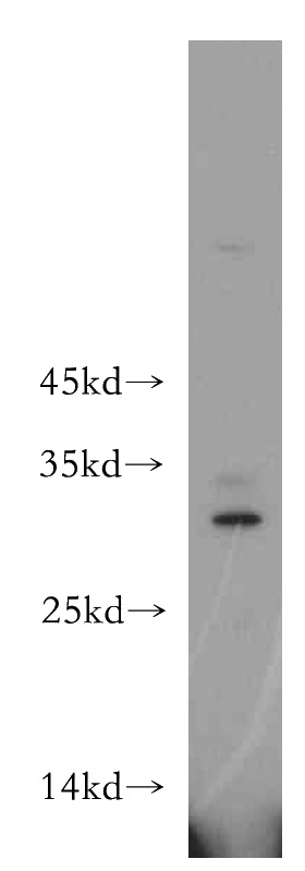 HEK-293 cells were subjected to SDS PAGE followed by western blot with Catalog No:116040(THAP2 antibody) at dilution of 1:600