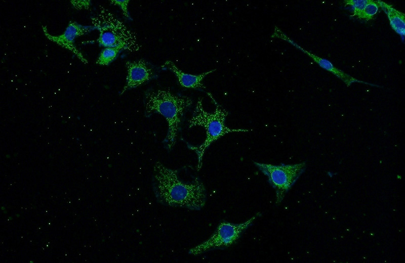 Immunofluorescent analysis of SH-SY5Y cells using Catalog No:109571(DPYSL2 Antibody) at dilution of 1:50 and Alexa Fluor 488-congugated AffiniPure Goat Anti-Rabbit IgG(H+L)