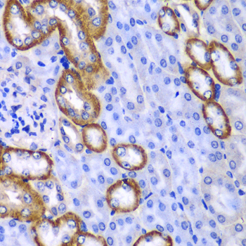 Immunohistochemistry - MYO1C Polyclonal Antibody 