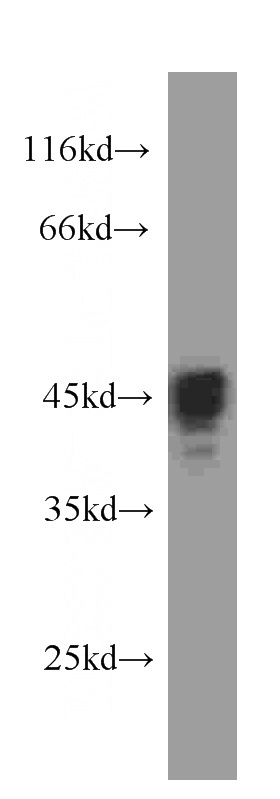 human brain tissue were subjected to SDS PAGE followed by western blot with Catalog No:107295(GFAP antibody) at dilution of 1:10000