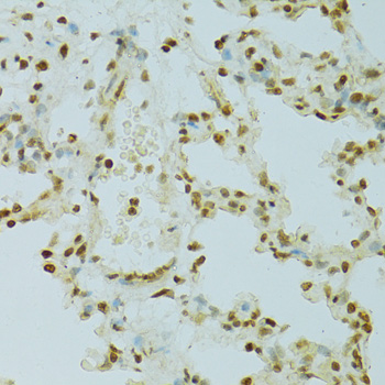 Immunohistochemistry - RCC1 Polyclonal Antibody 