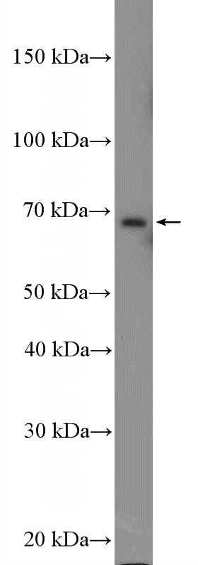 HepG2 cells were subjected to SDS PAGE followed by western blot with Catalog No:110227(EHHADH Antibody) at dilution of 1:2000