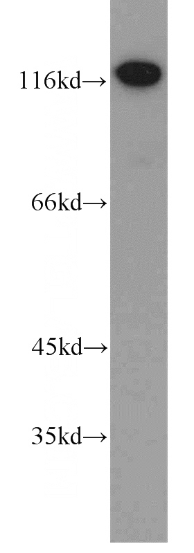 K-562 cells were subjected to SDS PAGE followed by western blot with Catalog No:107867(ADD1 antibody) at dilution of 1:800