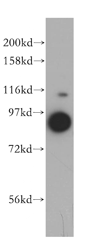 HepG2 cells were subjected to SDS PAGE followed by western blot with Catalog No:116773(VPS16 antibody) at dilution of 1:500