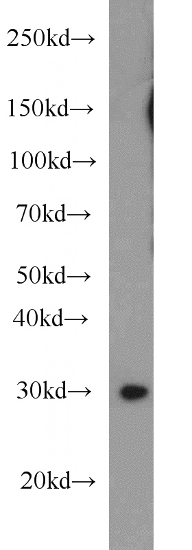 MCF7 cells were subjected to SDS PAGE followed by western blot with Catalog No:112765(MTAP antibody) at dilution of 1:500