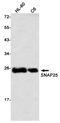 Western blot detection of SNAP25 in HL-60,C6 using SNAP25 Rabbit mAb(1:1000 diluted)