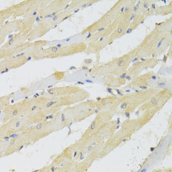 Immunohistochemistry - TRAP1 Polyclonal Antibody 