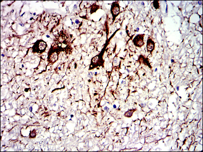 Fig4: Immunohistochemical analysis of paraffin-embedded medulla oblongata tissues using anti-TUBA8 antibody. Counter stained with hematoxylin.