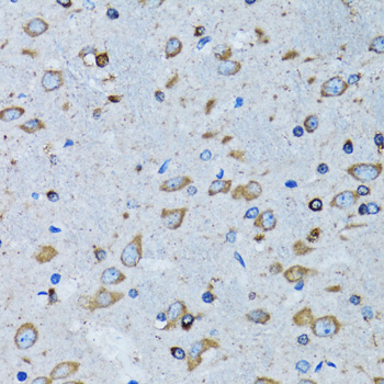 Immunohistochemistry - RARS Polyclonal Antibody 