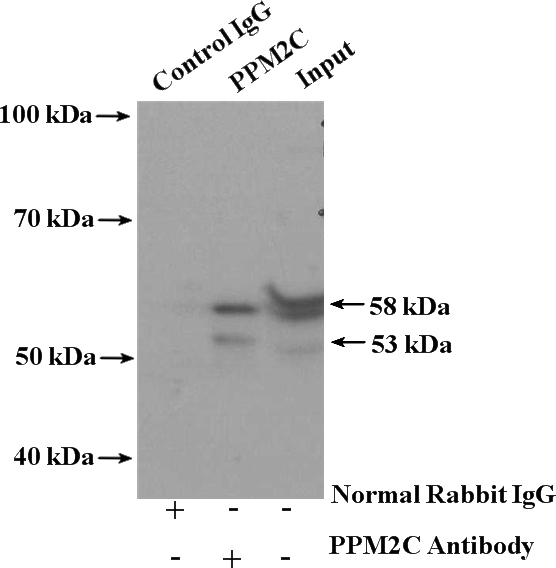 IP Result of anti-PPM2C (IP:Catalog No:114139, 4ug; Detection:Catalog No:114139 1:300) with mouse brain tissue lysate 5200ug.
