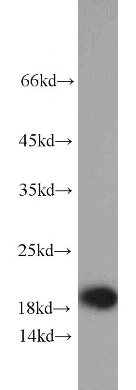 mouse cerebellum tissue were subjected to SDS PAGE followed by western blot with Catalog No:116064(TNFAIP8L2 antibody) at dilution of 1:500