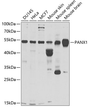 Western blot - PANX1 Polyclonal Antibody 