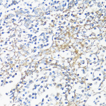 Immunohistochemistry - HSD17B10 Polyclonal Antibody 