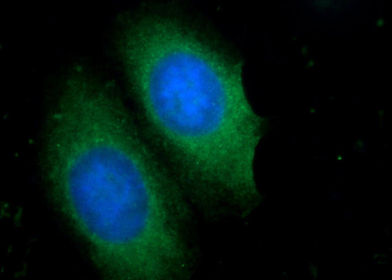 Immunofluorescent analysis of HepG2 cells using Catalog No:117048(ZFYVE28 Antibody) at dilution of 1:25 and Alexa Fluor 488-congugated AffiniPure Goat Anti-Rabbit IgG(H+L)