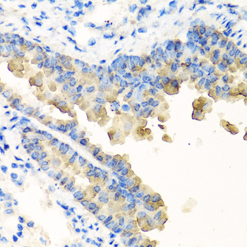 Immunohistochemistry - NYX Polyclonal Antibody 