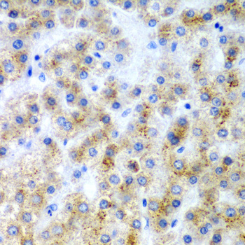 Immunohistochemistry - LY86 Polyclonal Antibody 