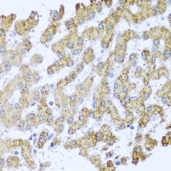 Immunohistochemistry - MOK Polyclonal Antibody 