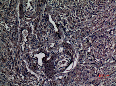 Immunohistochemical analysis of paraffin-embedded human-uterus, antibody was diluted at 1:100