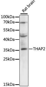Western blot - THAP2 Polyclonal Antibody 