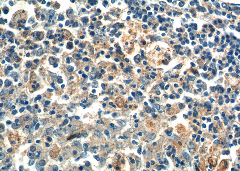 Immunohistochemistry of paraffin-embedded human spleen tissue slide using Catalog No:114254(PSPH Antibody) at dilution of 1:100 (under 40x lens).