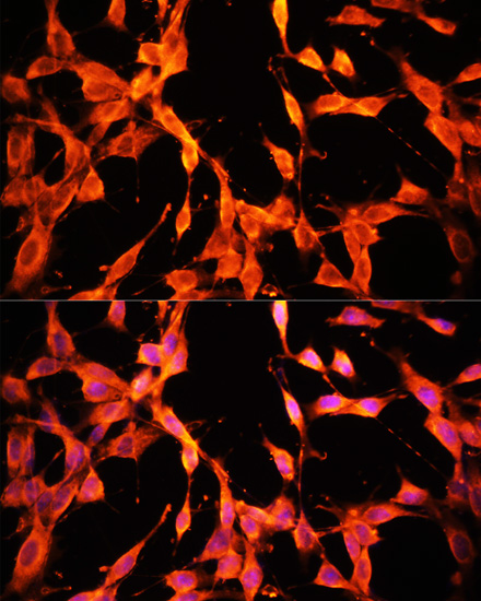 Immunofluorescence - MST1 Polyclonal Antibody 