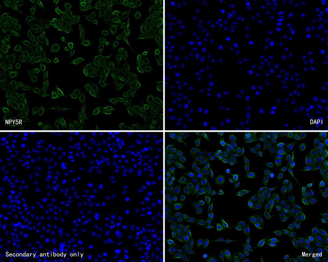 Fig3:; ICC staining of NPY5R in SiHa cells (green). Formalin fixed cells were permeabilized with 0.1% Triton X-100 in TBS for 10 minutes at room temperature and blocked with 1% Blocker BSA for 15 minutes at room temperature. Cells were probed with the primary antibody ( 1/50) for 1 hour at room temperature, washed with PBS. Alexa Fluor®488 Goat anti-Rabbit IgG was used as the secondary antibody at 1/1,000 dilution. The nuclear counter stain is DAPI (blue).