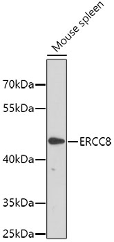 Western blot - ERCC8 Polyclonal Antibody 