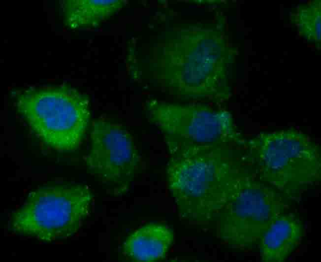 Fig3: ICC staining CD130 (green) in HUVEC cells. The nuclear counter stain is DAPI (blue). Cells were fixed in paraformaldehyde, permeabilised with 0.25% Triton X100/PBS.