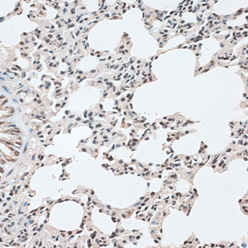 Immunohistochemistry - CBX6 Polyclonal Antibody 