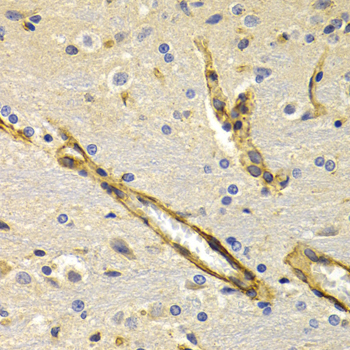 Immunohistochemistry - KLKB1 Polyclonal Antibody 
