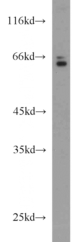 L02 cells were subjected to SDS PAGE followed by western blot with Catalog No:111259(HAS3 antibody) at dilution of 1:1000