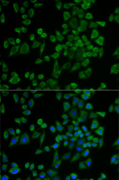 Immunofluorescence - P2RY2 Polyclonal Antibody 