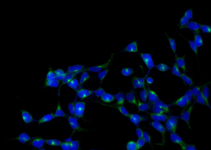 Immunofluorescent analysis of HEK-293 cells using Catalog No:114983(SCAMP2 Antibody) at dilution of 1:25 and Alexa Fluor 488-congugated AffiniPure Goat Anti-Rabbit IgG(H+L)