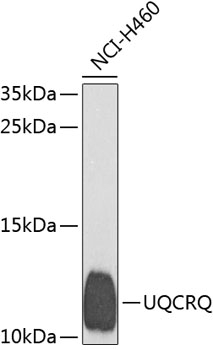 Western blot - UQCRQ Polyclonal Antibody 