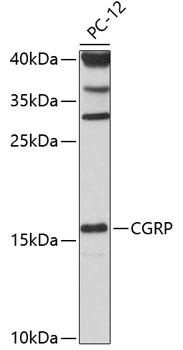Western blot - CGRP Polyclonal Antibody 