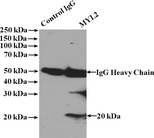 IP Result of anti-MYL2 (IP:Catalog No:112942, 4ug; Detection:Catalog No:112942 1:500) with mouse brain tissue lysate 4000ug.