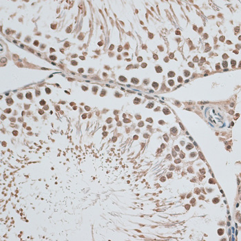 Immunohistochemistry - CBX6 Polyclonal Antibody 