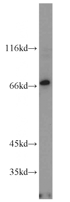 COLO 320 cells were subjected to SDS PAGE followed by western blot with Catalog No:113316(NCF2 antibody) at dilution of 1:500