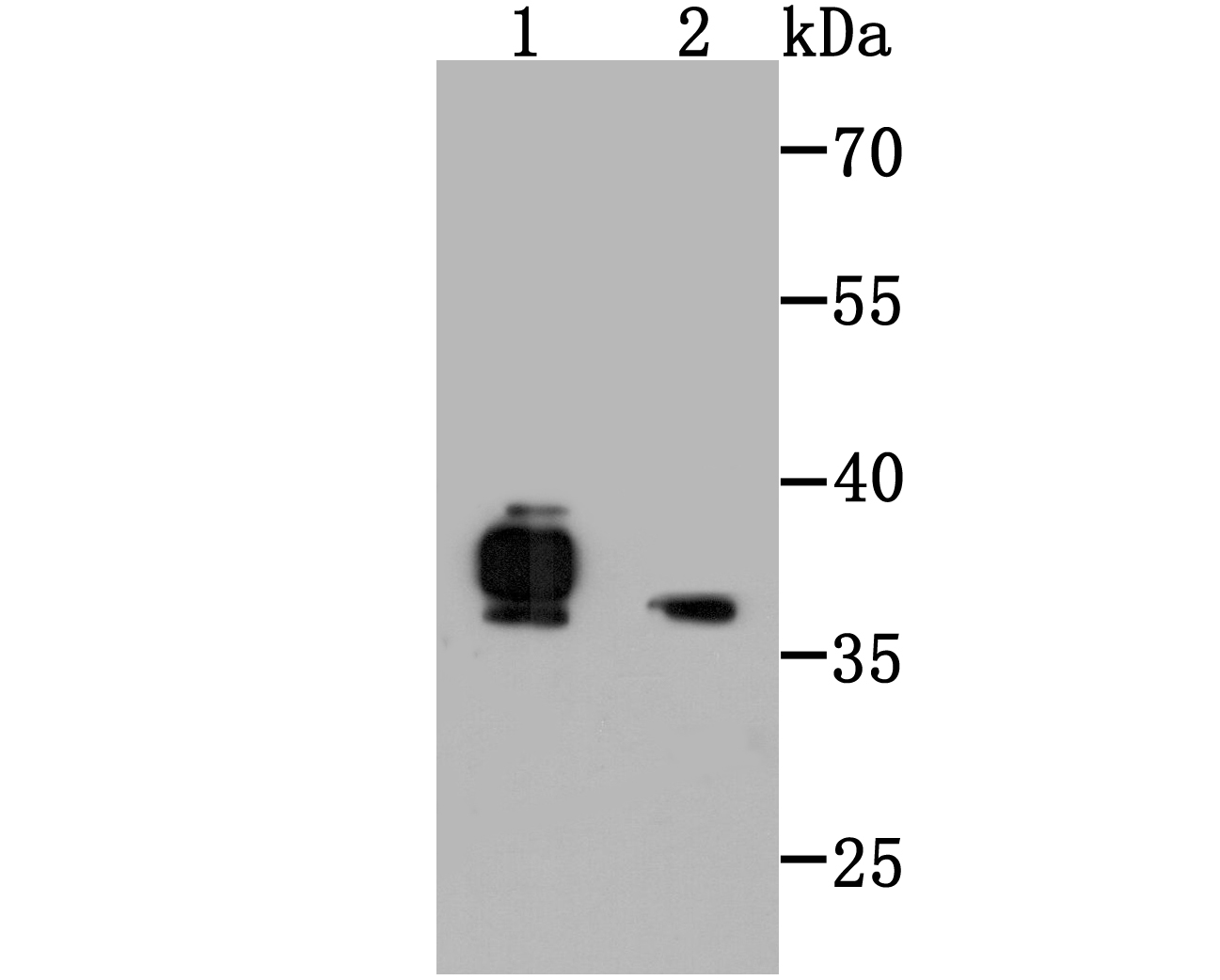Fig1: Western blot analysis of FPR1 on MEF (1) and HES (2) cell lysate using anti-FPR1 antibody at 1/500 dilution.