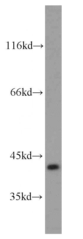 mouse brain tissue were subjected to SDS PAGE followed by western blot with Catalog No:115314(SLC22A18 antibody) at dilution of 1:1000