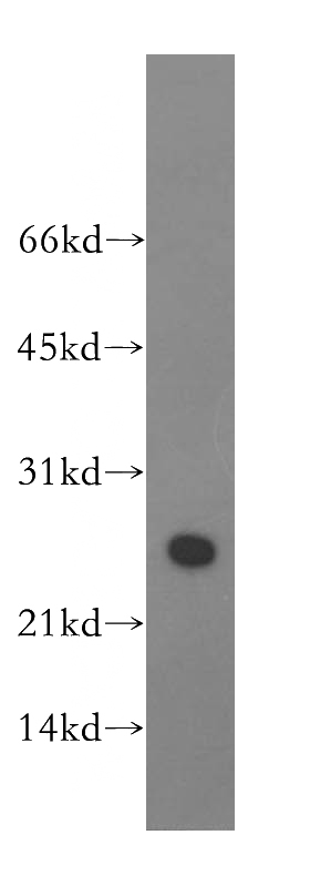human brain tissue were subjected to SDS PAGE followed by western blot with Catalog No:108221(ASF/SF2 antibody) at dilution of 1:1000