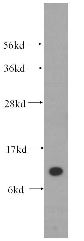 mouse liver tissue were subjected to SDS PAGE followed by western blot with Catalog No:115088(SEC61B-Specific antibody) at dilution of 1:500