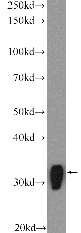 mouse brain tissue were subjected to SDS PAGE followed by western blot with Catalog No:112448(MARCKS Antibody) at dilution of 1:600